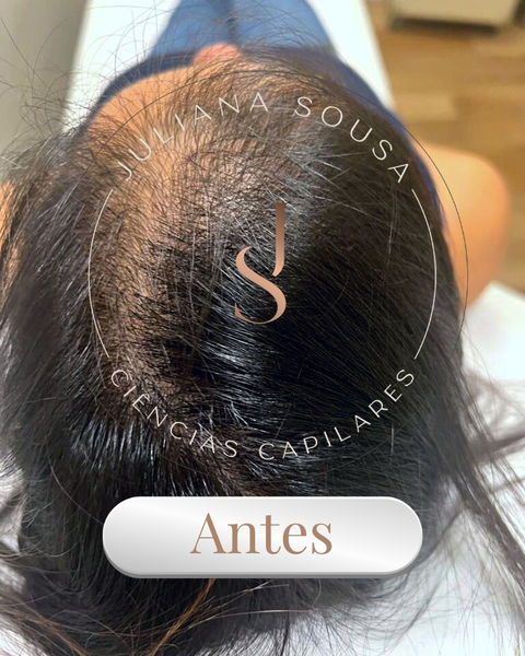 Tratamento Capilar