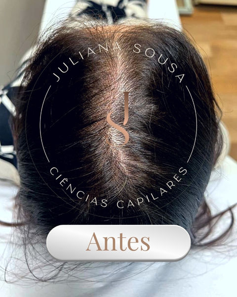 Tratamento Capilar