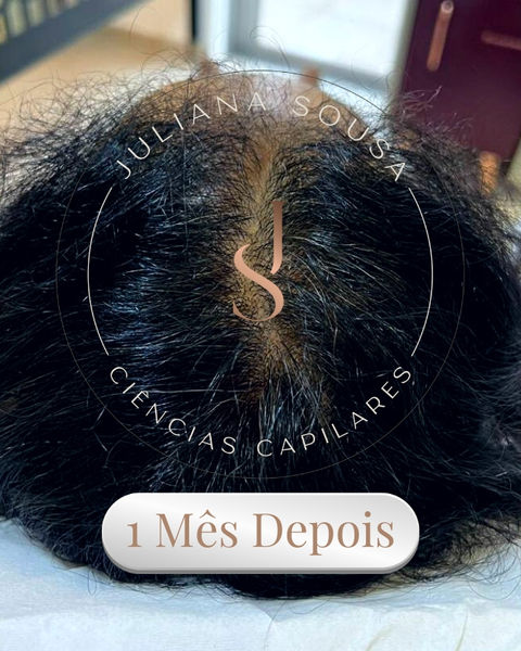 Tratamento Capilar
