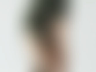 The Double-Edged Sword of Hypermobility: Flexibility and Fragility