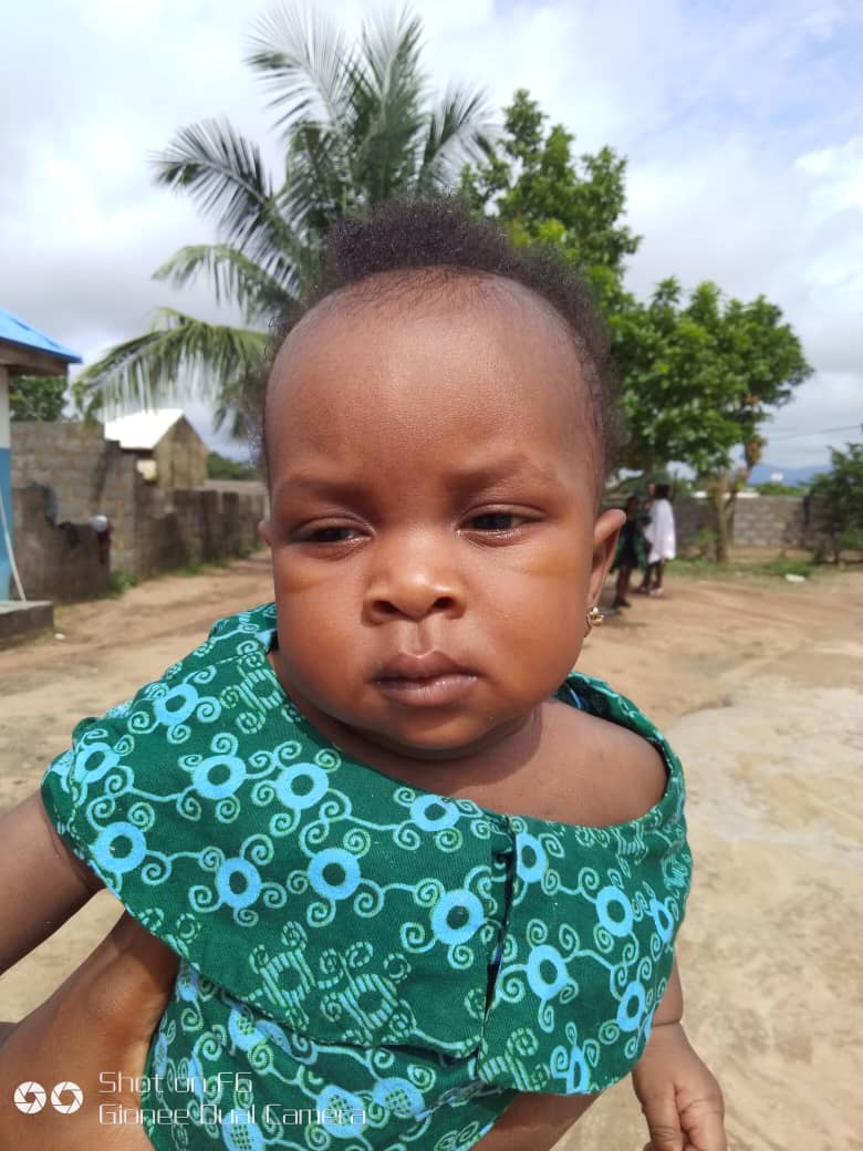 Mircale, 5 months