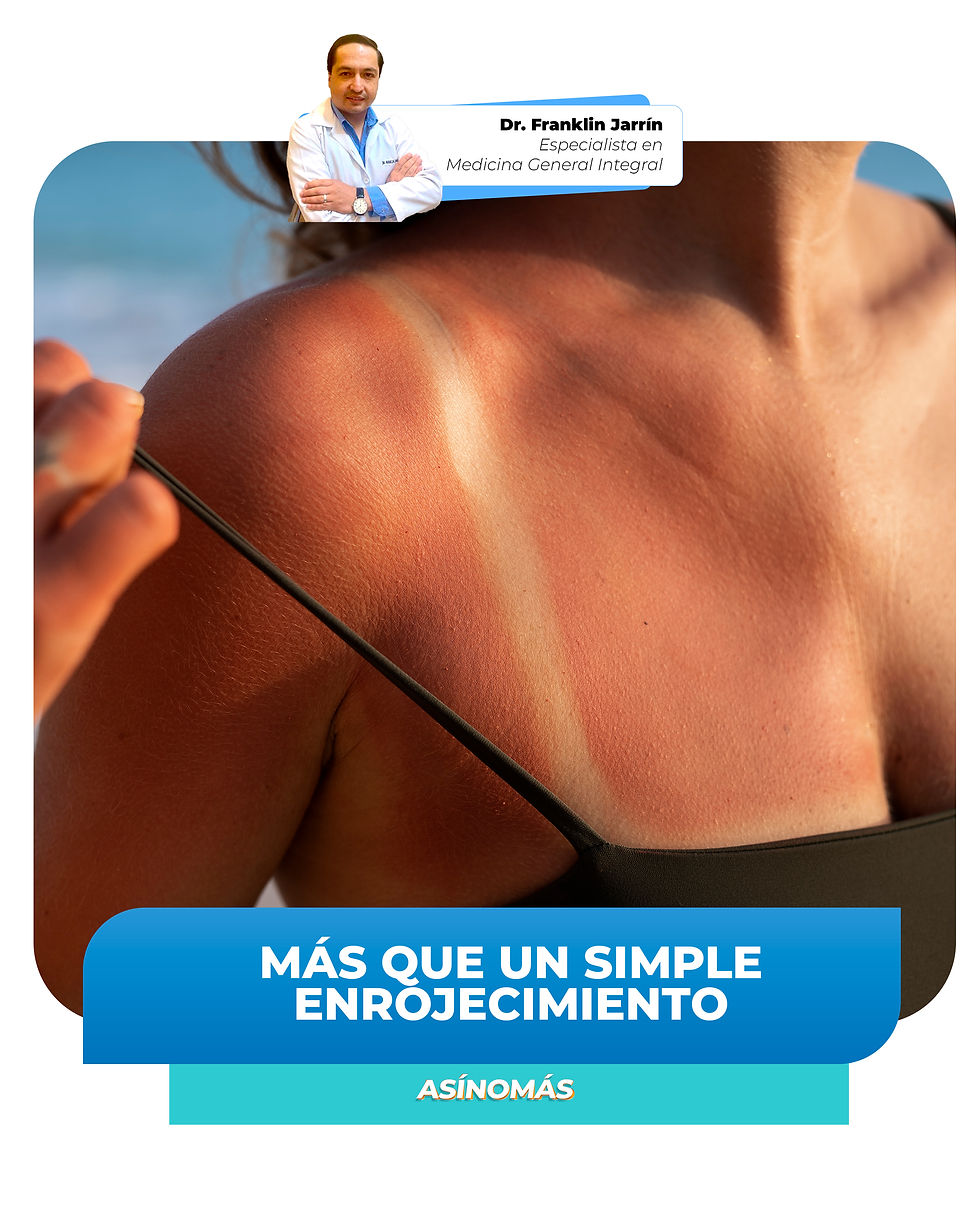 Más que un simple enrojecimiento.