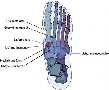 Lisfranc foot diagram Dr. Andrew Gunter DPM