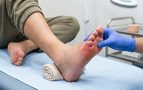 Sesamoiditis and sesamoid bone pain treatment in San Antonio TX by Dr. Andrew Gunter DPM — dancers runners athletes