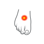 top of foot pain.png