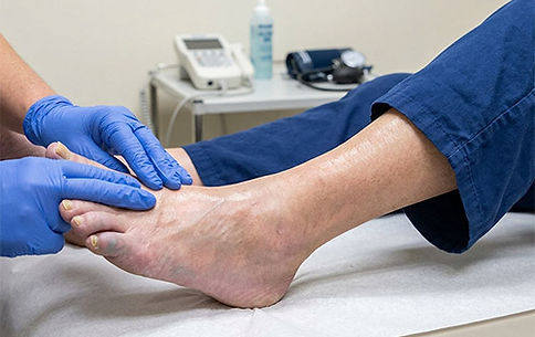 Peripheral vascular disease foot evaluation and care in San Antonio TX by Dr. Andrew Gunter DPM — vascular assessment and referral