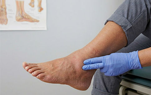 Ankle arthritis treatment in San Antonio TX by Dr. Andrew Gunter DPM — conservative and surgical options