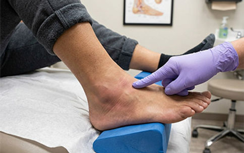 Peroneal tendinitis outer ankle pain treatment in San Antonio TX by Dr. Andrew Gunter DPM