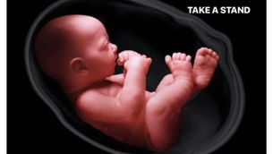 Pregnancy is not a disease and abortion is not “health care”!