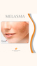 MELASMA