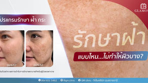 รักษาฝ้าแบบไหน...ไม่ทำให้ผิวบาง?