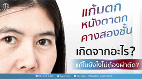 แก้มตก คางสองชั้น หนังตาตก… เกิดจากอะไร? แก้ไขยังไงแบบไม่ต้องผ่าตัด