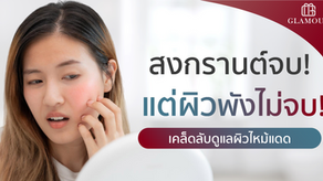 สงกรานต์จบ แต่ผิวพังไม่จบ! เคล็ดลับดูแลผิวไหม้แดดหลังสงกรานต์