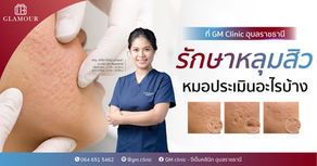 หมอประเมินอะไรบ้าง ก่อนวางแผนรักษาหลุมสิว? เพราะหลุมสิวแต่ละแบบ ใช้วิธีรักษาไม่เหมือนกัน
