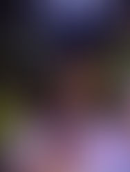 Allergan Night Gala 2018