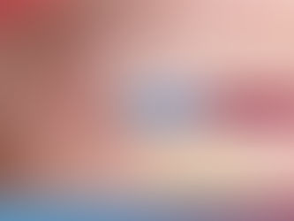 Subcision คืออะไร? วิธีตัดพังผืดหลุมสิวที่ช่วยให้หลุมลึกดูตื้นขึ้น