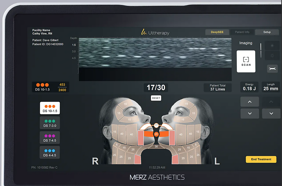 Ultherapy PRIME microfocused ultrasound handpiece