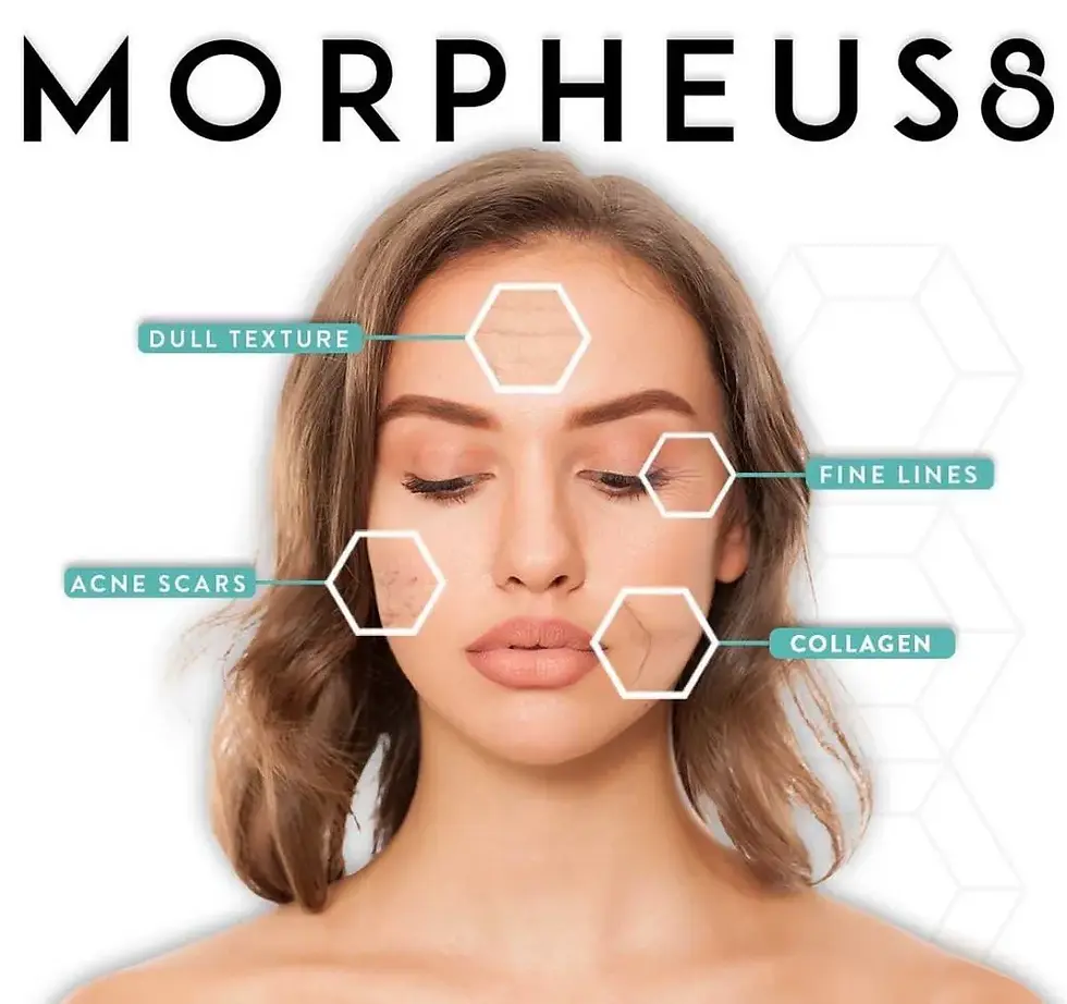 Morpheus-8.webp