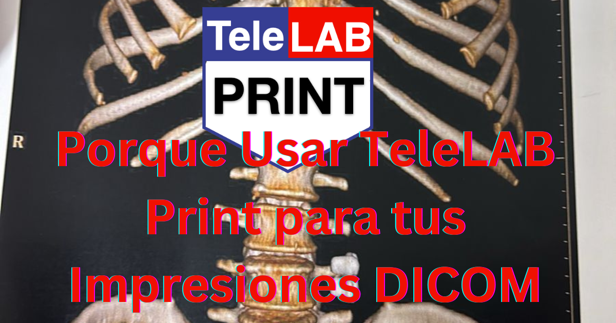 Tele Lab Porque Usar TeleLAB Print para tus Impresiones DICOM