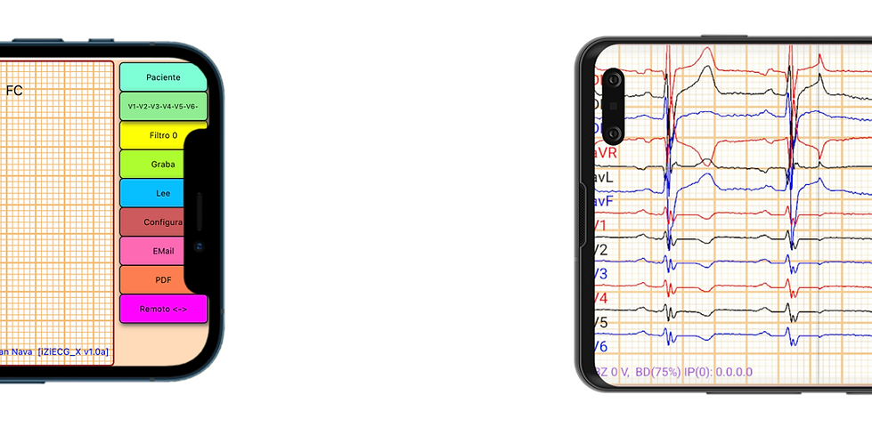 ECG en celulares