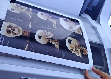 Imagen de impresiones de una tomografía craneal en una impresora fotográfica utilizando TeleLAB Print en una impresora que no es DICOM. La foto refleja la capacidad de imprimir imágenes médicas de manera conveniente, incluso sin estar vinculado a un sistema DICOM, gracias a la solución proporcionada por TeleLAB Print