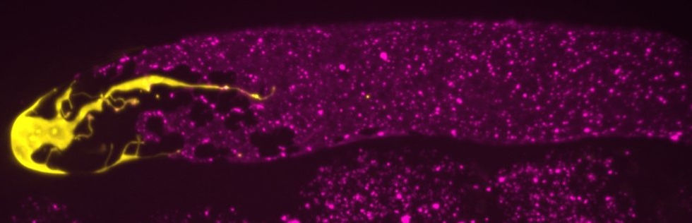 An adult hermaphrodite distal gonad with DTC in yellow and INX-8 in magenta
