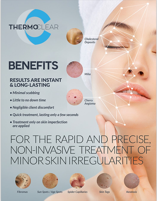A flyer showing skin irregularities that can be treated using the ThermoClear