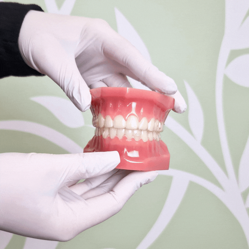 Urgent Dental Emergencies Blue Bird Dentistry & Aesthetics West London