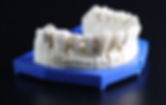 dentures-759928.jpg