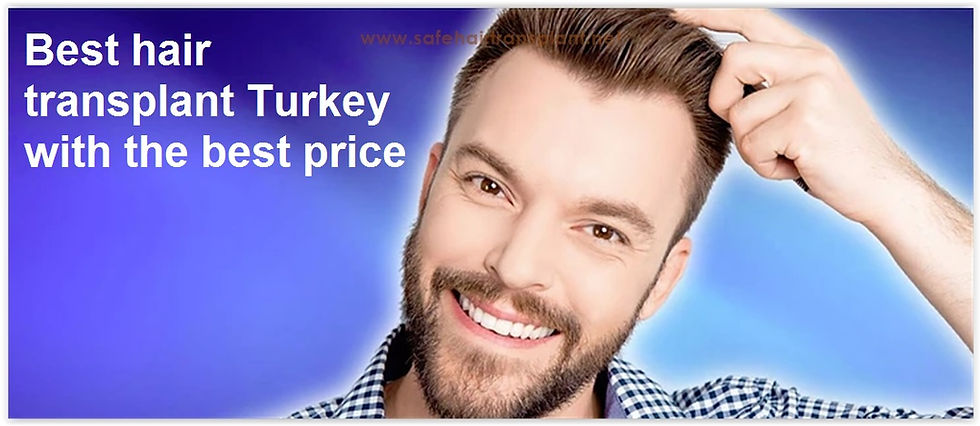 Best hair transplant Turkey with the best price