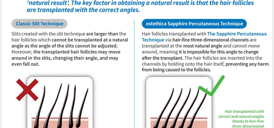 Shappire Hair Transplant Turkey step 2
