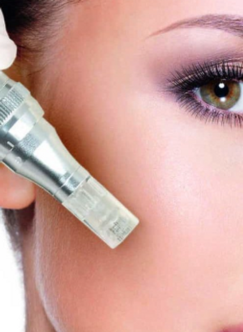 Rundumschön.ch-Microneedling-straffehaut-hautbildverbesserung-akne-narben