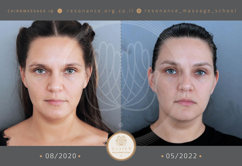 פנים לפני ואחרי עיסוי כירומסאז' IQ