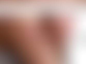 Psoriasis is Curable in Ayurveda: Detox, Healing Butter, and Lasting Relief