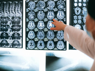 3 Drinks for Better Brain Health...