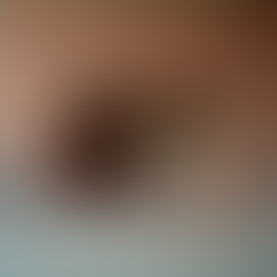 Effective Solutions for Fixing Structural Movement Issues