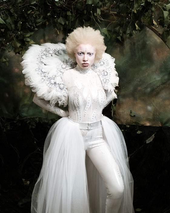 Striking images of albino model Nan Mthembu taken by Aemilia Cumberland