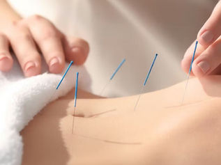 Women recieving a calming acupuncture treatment to help balance hormones and for fertility at Sarah Johnson Acupuncture