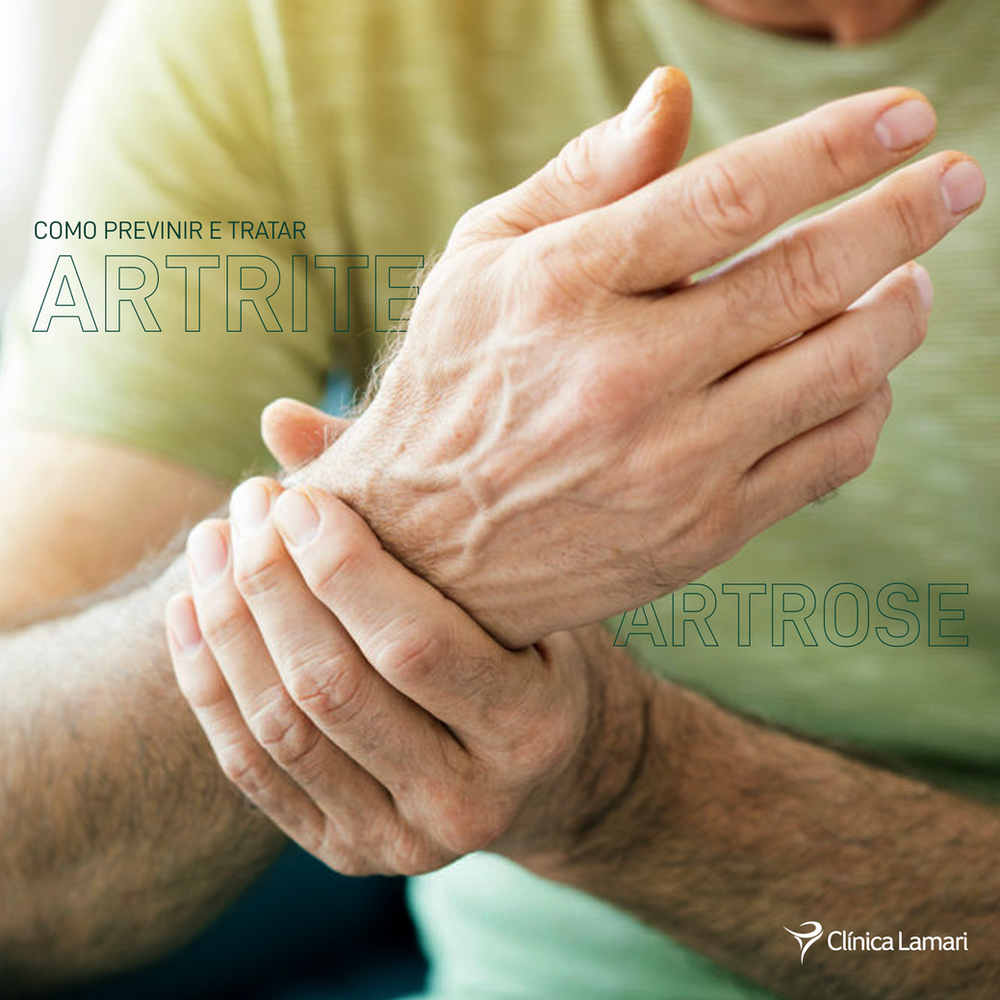 Como Prevenir e Tratar Artrite e Artrose Como Prevenir e Tratar Artrite e Artrose
