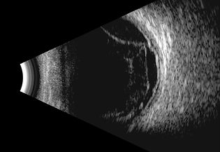 Ultrasound.jpg