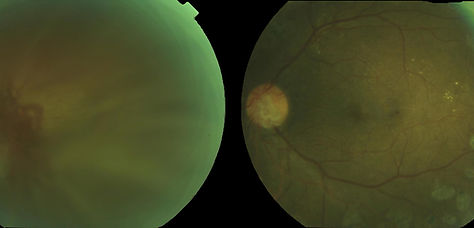 Before and After Surgery.jpg