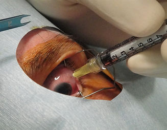 Injection.jpg