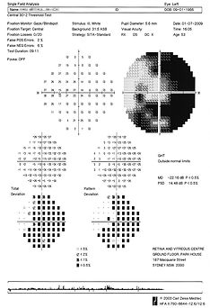 Visual Field Test.jpg