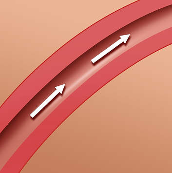 BloodVessel_PPHN_Cross-section.png
