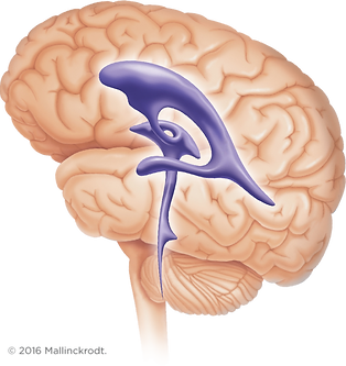 Brain_Ventricle.png