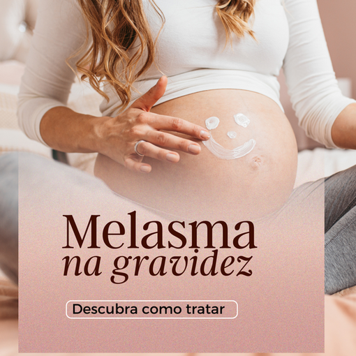 Melasma na Gravidez: O Que É e Como Tratar