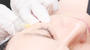 Webinar: Carboxiterapia em 2022