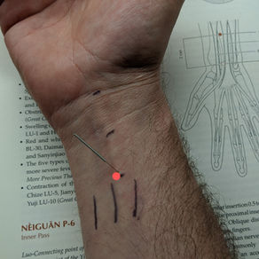 What's the Point? Nèi Guān, P6