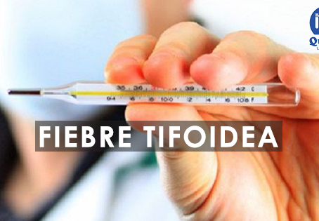 Fiebre Tifoidea - Síntomas y Causas