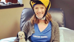 Patient Story | Cold capping to save my hair